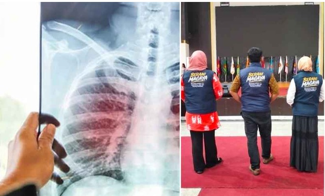 Penyebaran TBC di Palu Mengkhawatirkan, FKM Untad Sebar Ribuan Mahasiswa Tangani Korban
